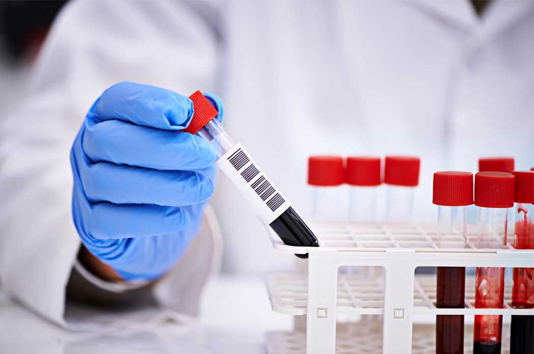 STD Screening & Treatment